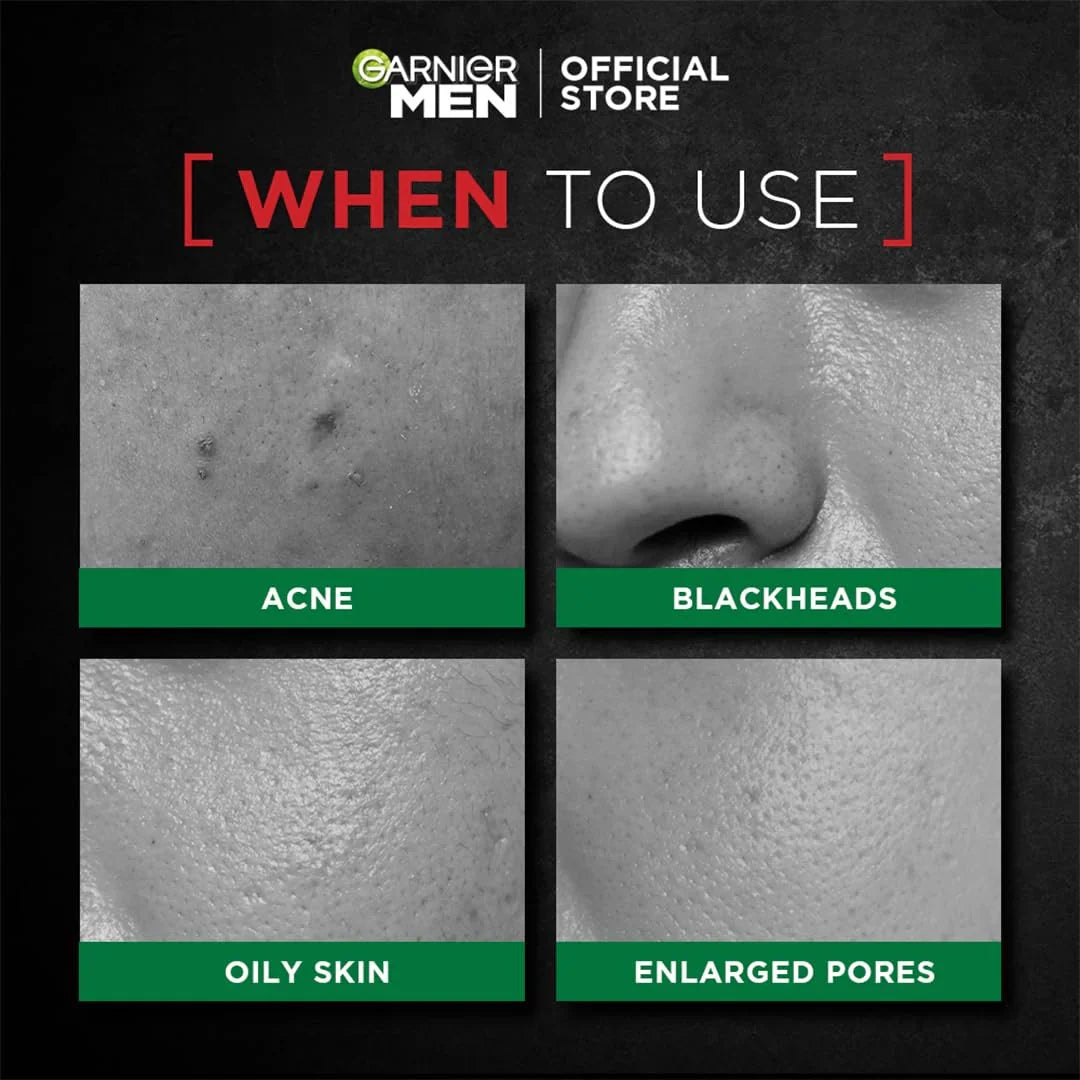 Garnier Men Acno Fight XL Tissue Mask Men, 5X Salicylic Acid and Charcoal Powder, Fight Pimple causing Germs in 5 min, Suitable for all Skin types, 22g