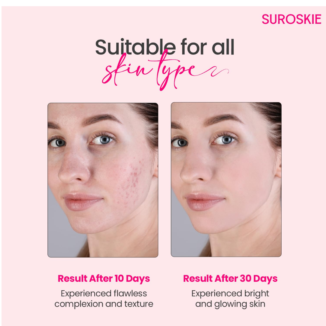 SUROSKIE Rose Instant Enzyme Face Scrub 50ml | India’s First Enzyme Scrub For Glowing Skin, Cleans Pores & Dark Spots | Clear White & Black Head | Rose, AHA+ BHA & Cellulose Extract| For Men & Women