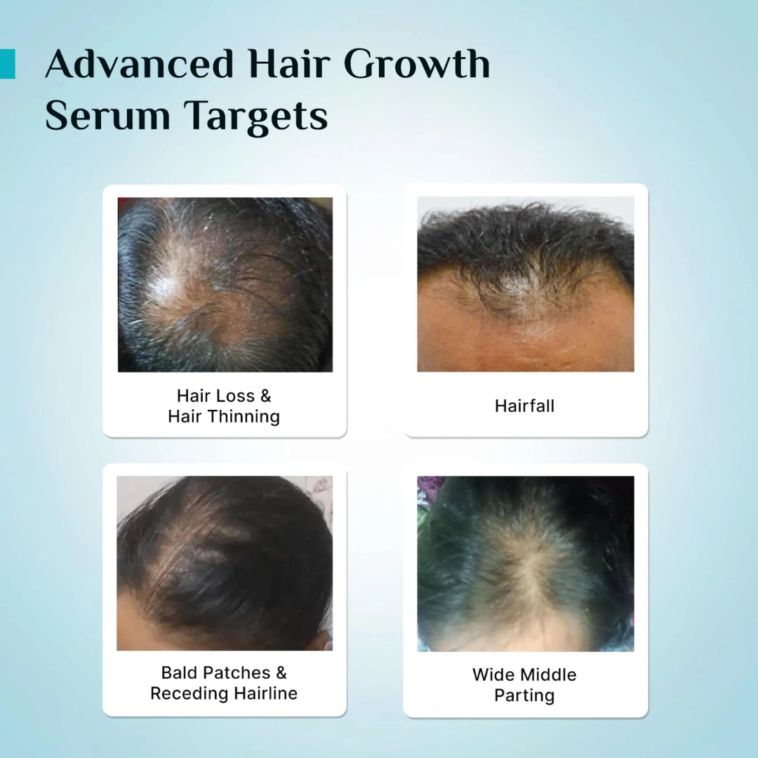 PILGRIM Redensyl 3%+Anagain 4% Advanced Hair Growth Serum For Scalp (50Ml)