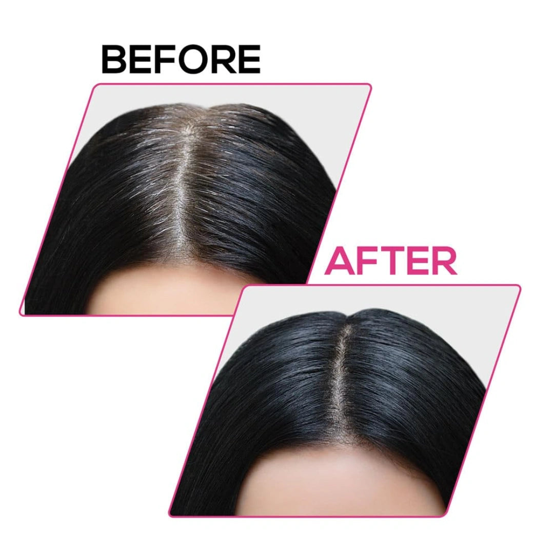 RENEE Cover-Up Hair Powder - Black | Covers Grey Roots & Bald Spots Instantly | Highly Pigmented, Fuller & Denser Look 4gm