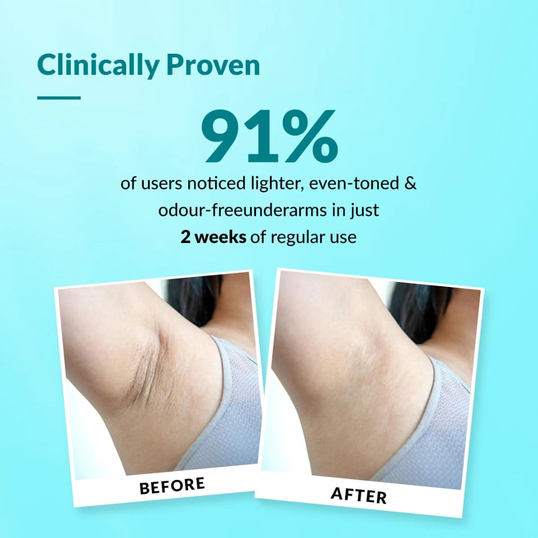 Fixderma Nigrifix Underarm Ocean Roll on With 6% AHA, Lactic Acid & 1% Mandelic Acid & Kojic Acid | Brightens Skin & Exfoliates Underarm | For Sensitive Skin - 60ml