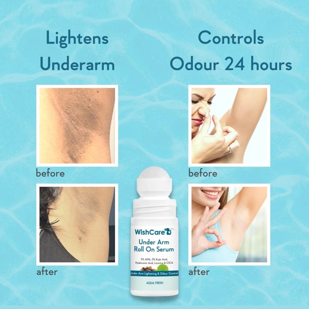 WishCare Underarm Roll On For Women & Men | Reduces Pigmentation, Brightens Skin & Prevents Body Odour | With AHA, Kojic Acid & Hyaluronic Acid | Long Lasting Aqua Fragrance | 50ml - Deals999