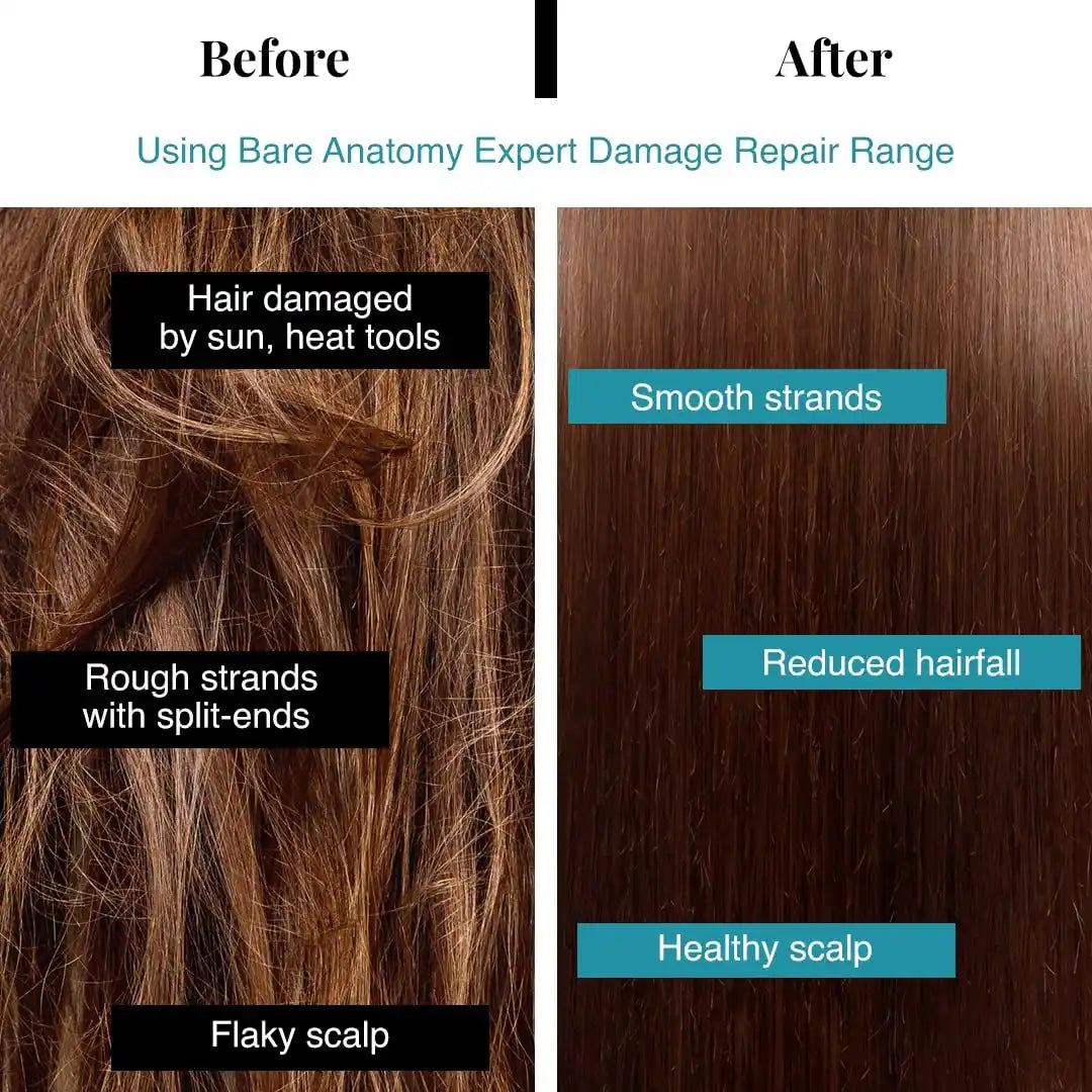 Bare Anatomy Damage Repair Hair Shampoo | Provides 10x Strengthening Powered By Ceramide A2 & Coconut Milk Protein | For Damaged, Dry & Frizzy Hair | Sulphate & Paraben Free | For Women & Men | 250ml