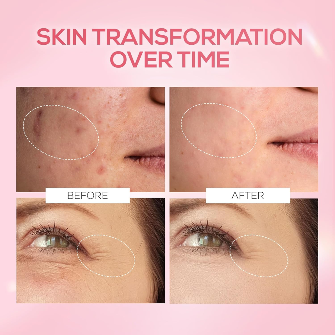 RENEE Pink Therapy PDRN Pink Peptide Face Serum For Glowing, Radiant Skin | Hydrates, Boosts Collagen, Evens Skin Tone | Lightweight, Quick Absorbing | Hyaluronic Acid & Niacinamide Infused | 30 ml