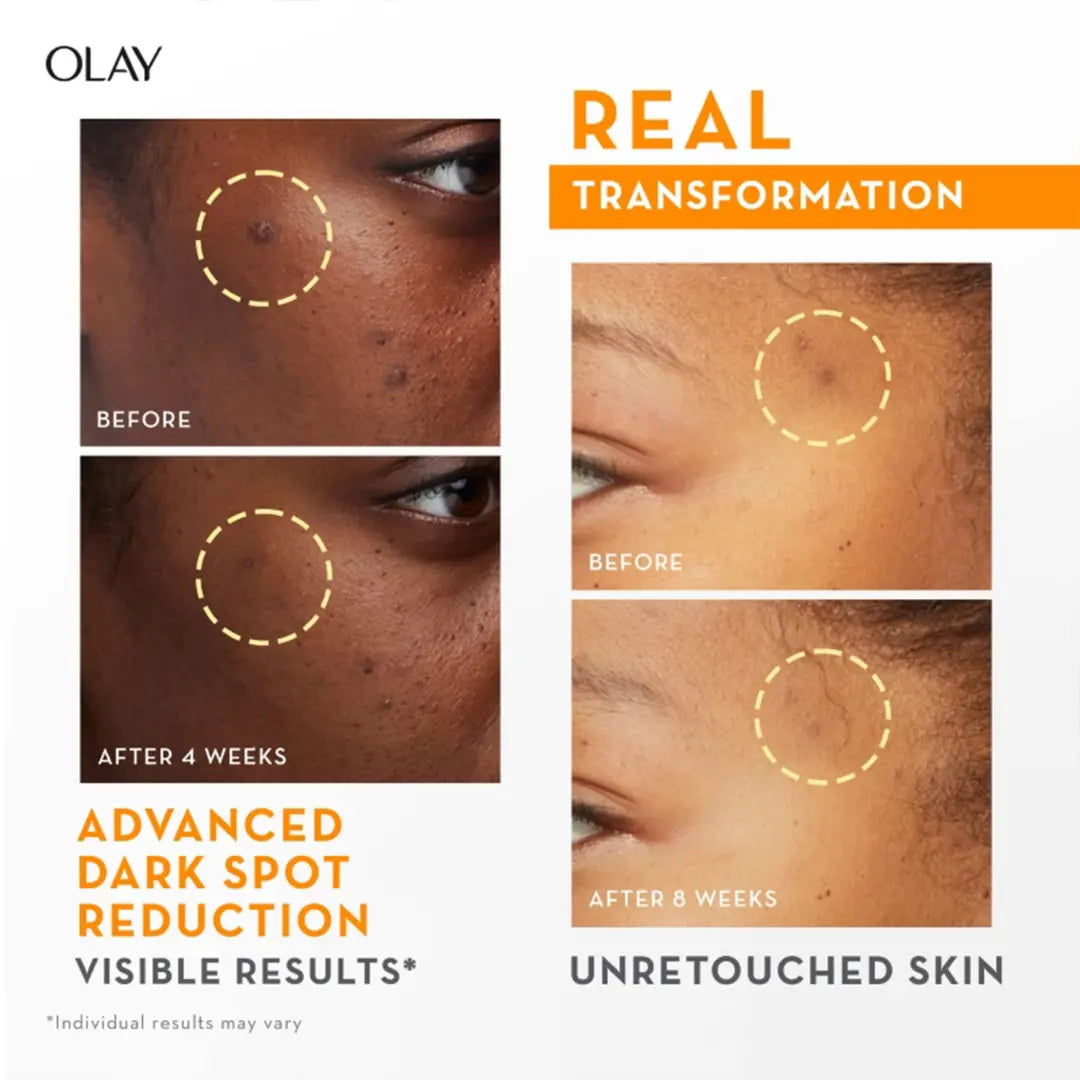 Olay Vitamin C Kit for 2X Glow | Vitamin C Cream with Free Cleanser l Even Glow and Smooth Texturee | With Niacinamide l Normal, Oily, Dry & Combination Skin l Parabens & Sulphate free |