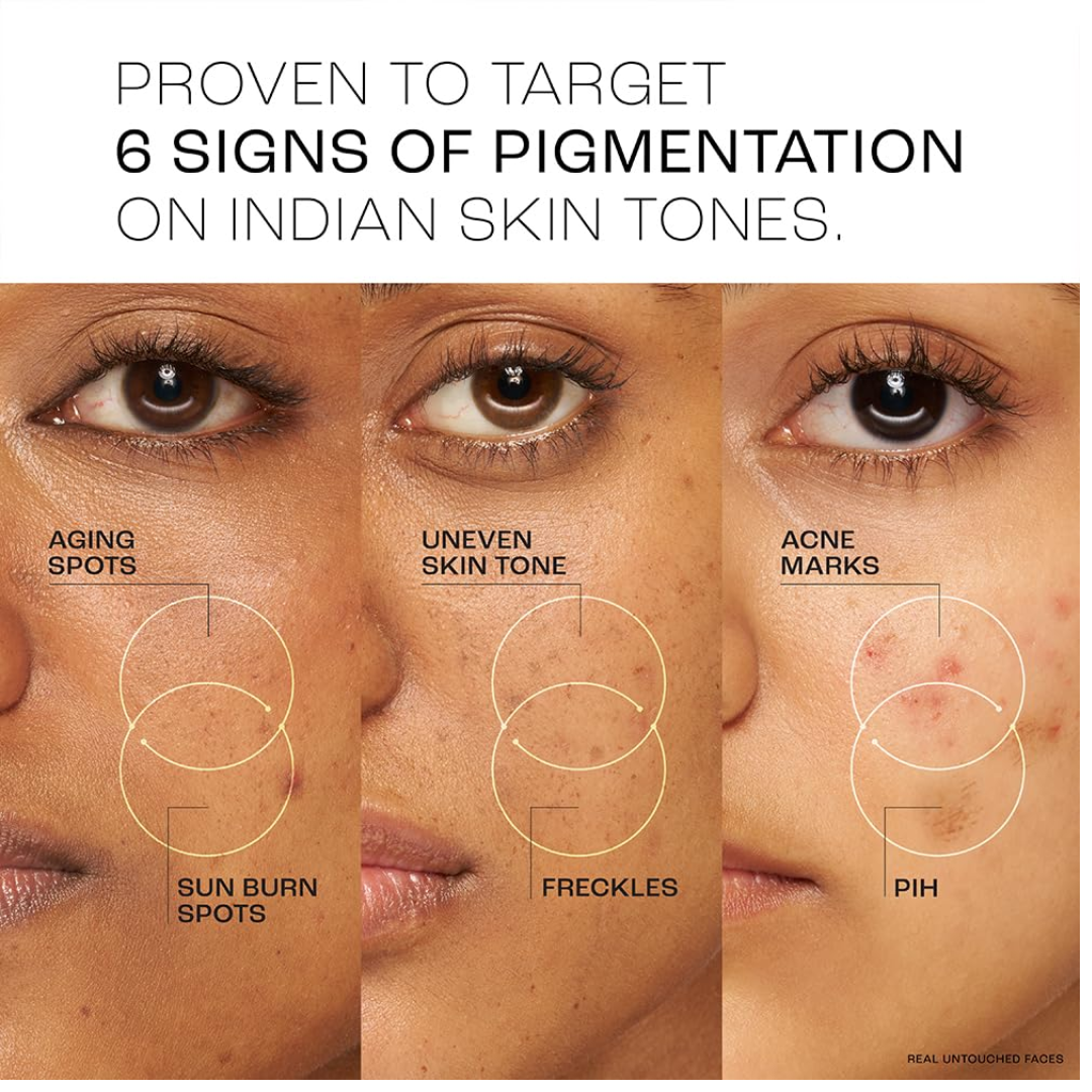 Lakme Perfect Radiance Night Cream 50g with Niacinamide to target pigmentation, night moisturiser