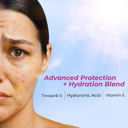 SUNSTOP Acne Gel SPF 80 - Ultra-Matte, Oil-Free Sunscreen for Acne-Prone 50gm