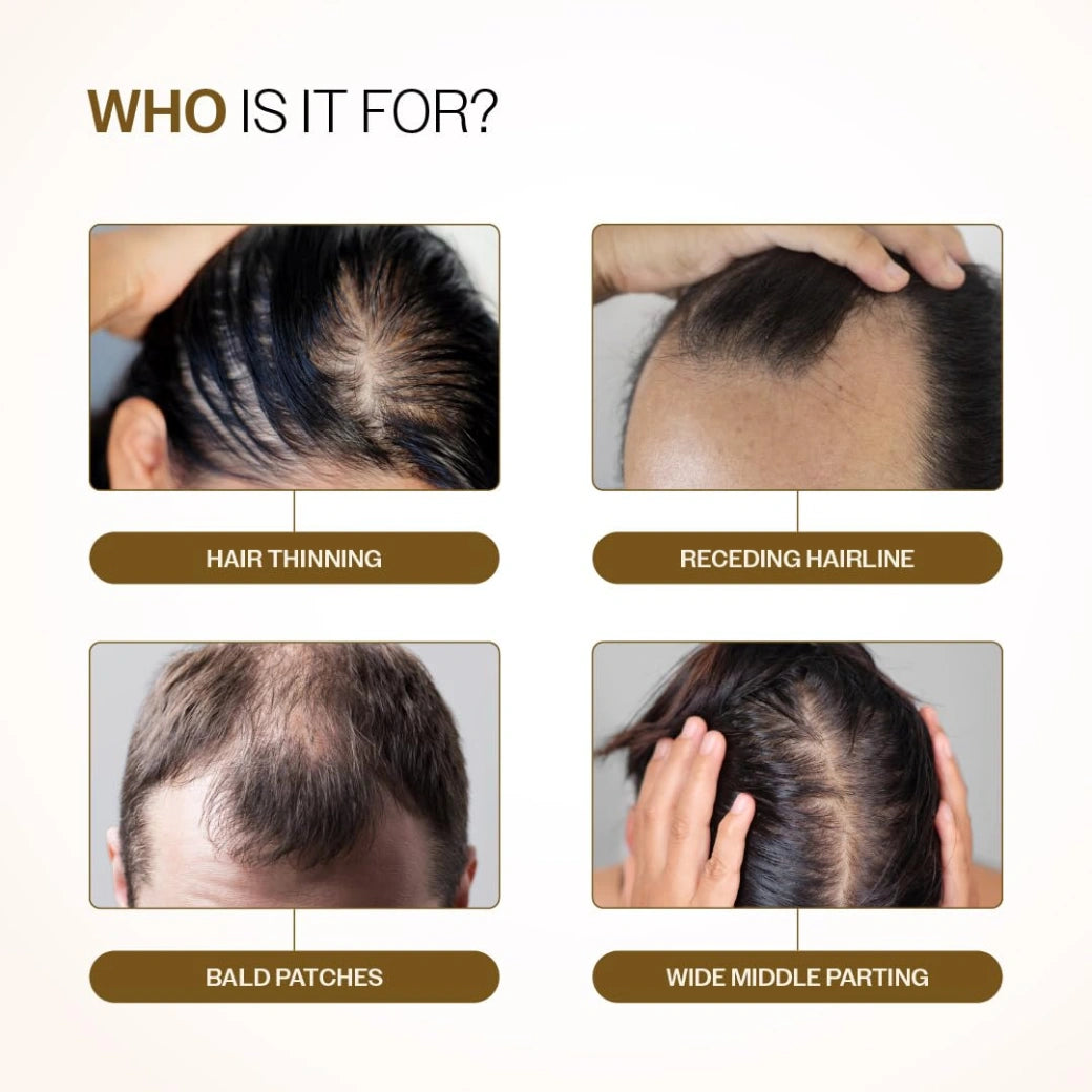Bare Anatomy Advanced Hair Growth Serum Roll-On| 3% Redensyl + 4% Anagain + 2% Baicapil + 5% Rosemary, Rice Water, Biotin & Saw Palmetto| Reduces Hair Fall, Supports Hair Growth for Men & Women | 25ml