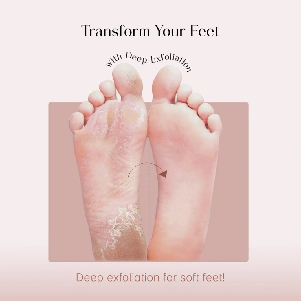 SeoulSkin Glycolic Acid Foot Peeling Mask (1 Pair), Korean Peeling & Exfoliating | Deep Exfoliation with Glycolic Acid, Removes Dead Skin, Cruelty-Free, Foot Peel Off Mask