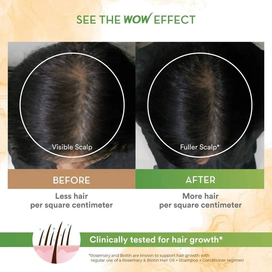 WOW Skin Science Rosemary Oil & Biotin Hair Growth Kit - Complete Care for Breakage-Prone Hair - Oil, Shampoo, Conditioner  (700ml)