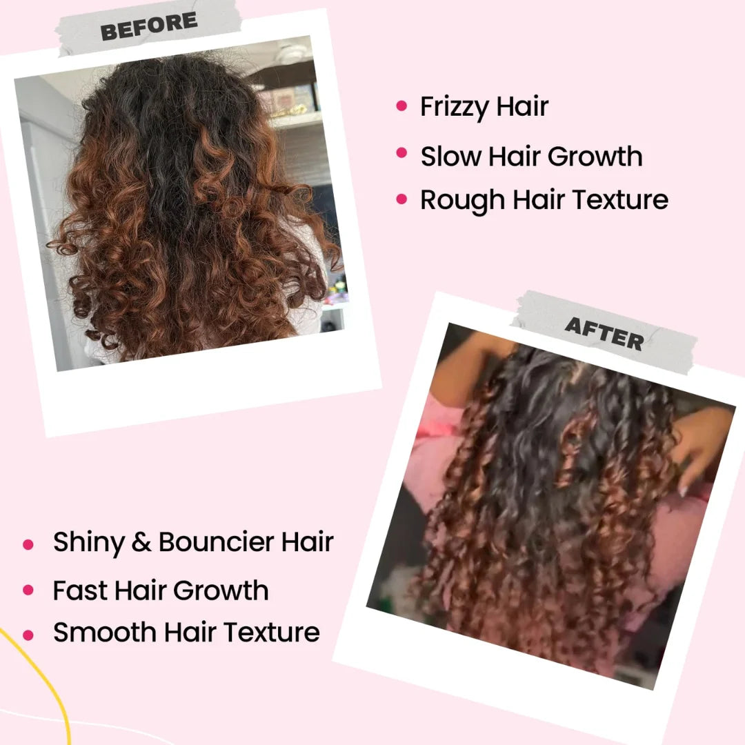 CHICNUTRIX Bounce|20 Raspberry Flavoured Effervescent Tablet 100 grams (pack of 3)