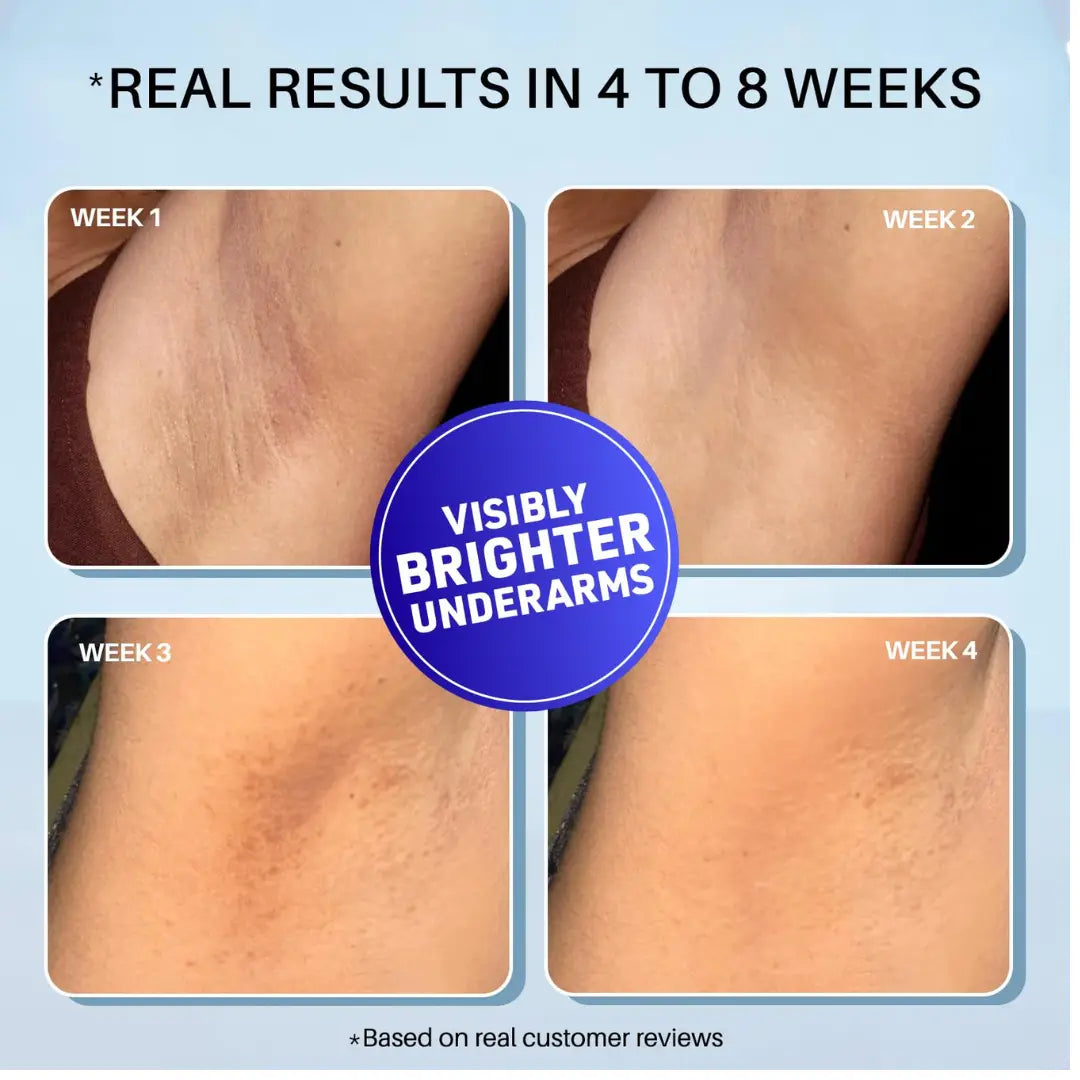 DermDoc 5% Glycolic Acid Underarm Brightening Spray Treatment (100 Ml)|Multipurpose Exfoliating Toner For Dark Spots On Face & Body|Helps With Dark Neck & Knees,Strawberry Legs With 2% Salicylic Acid