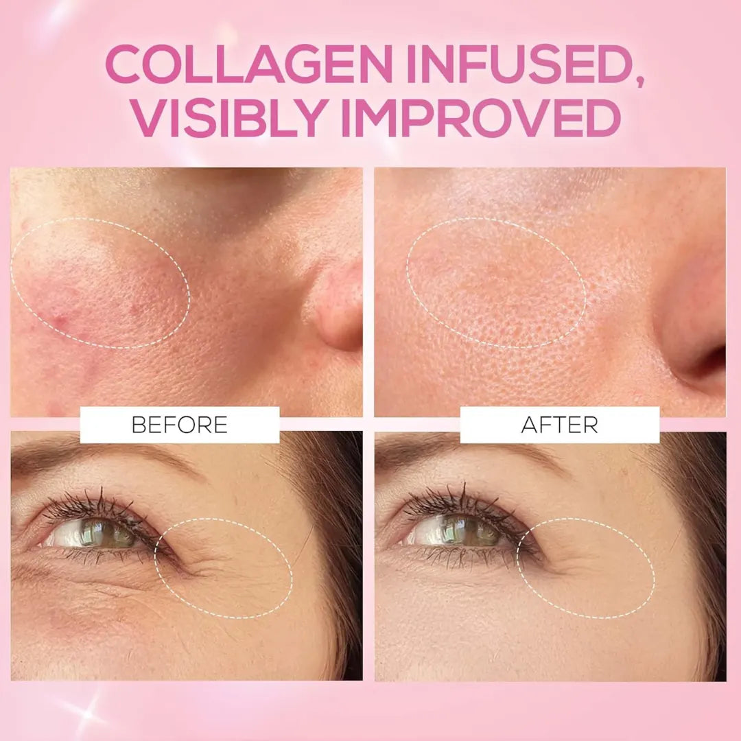 RENEE Pink Therapy Hydrolyzed Collagen Overnight Sleep Jelly Mask | Hydrates, Repairs, Smoothens & Plumps Skin | Peptides, Niacinamide & Hydrolyzed Collagen Enriched | 50 gm