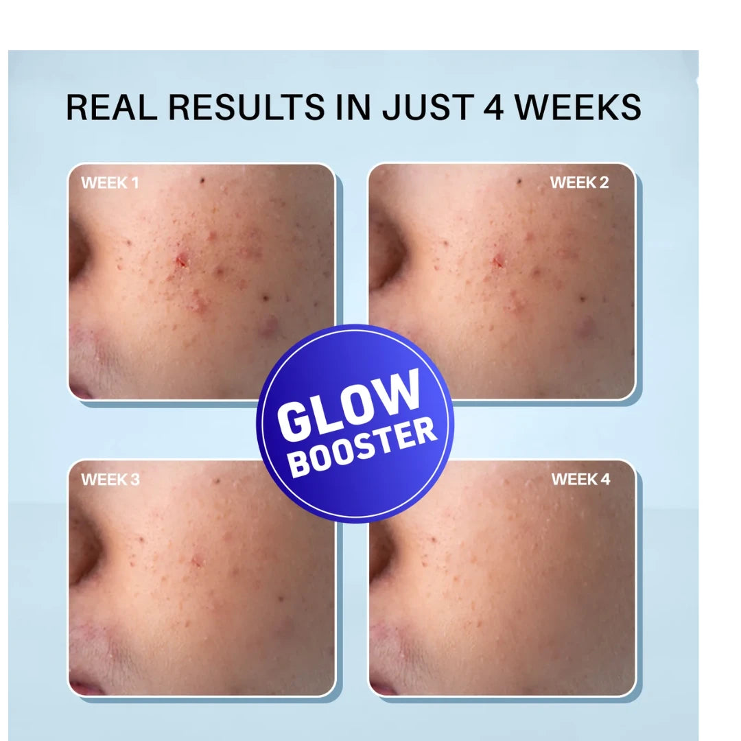 DERMDOC 2% Kojic Acid Glow Fusion Formula Night Cream with Niacinamide & Alpha Arbutin for Skin Brightening (50 gm) | Face Cream I Night Cream I Kojic Acid Brightening Cream I Glowing Skin