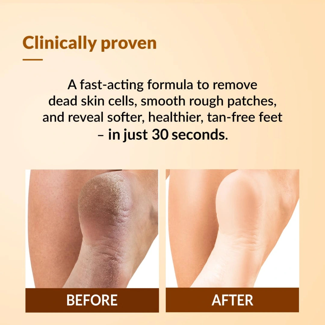 Fixderma Foobetik Foot Scrub Spray with Lactic Acid | 30 sec Foot Facial Spray | Foot Scrubber for Dead Skin | Callus Remover Spray | Heel Scrubber for Feet|Instantly Smooth & Soft Feet - 50ml