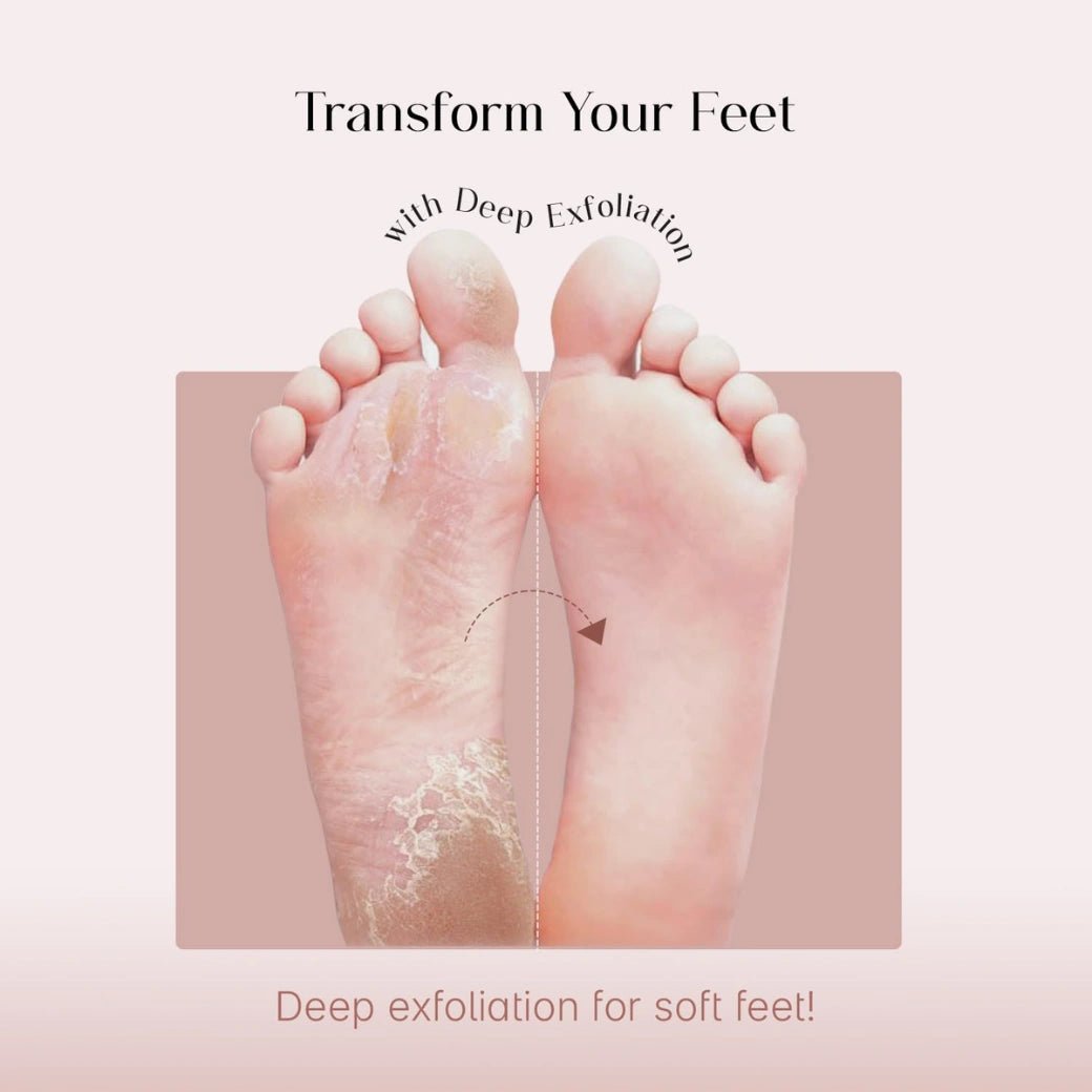 SeoulSkin Glycolic Acid Foot Peeling Mask (1 Pair), Korean Peeling & Exfoliating | Deep Exfoliation with Glycolic Acid, Removes Dead Skin, Cruelty-Free, Foot Peel Off Mask - Deals999