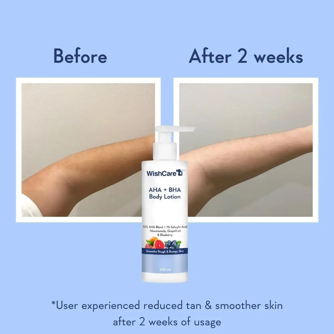 WishCare AHA BHA Body Lotion For Dry Skin | Provides Deep Hydration, Detans & Smooths Rough Skin| Body Lotion For Men & Women | 200ml - Deals999